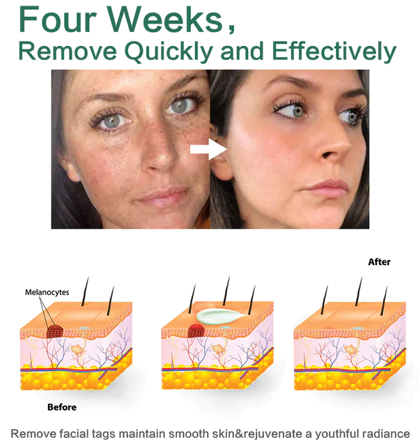 DOCTIA™Herbal Natural Spot & Mole Cream - Image 6