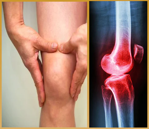 Ceoerty™ VitaFlex Joint & Bone Care Cream - Image 7