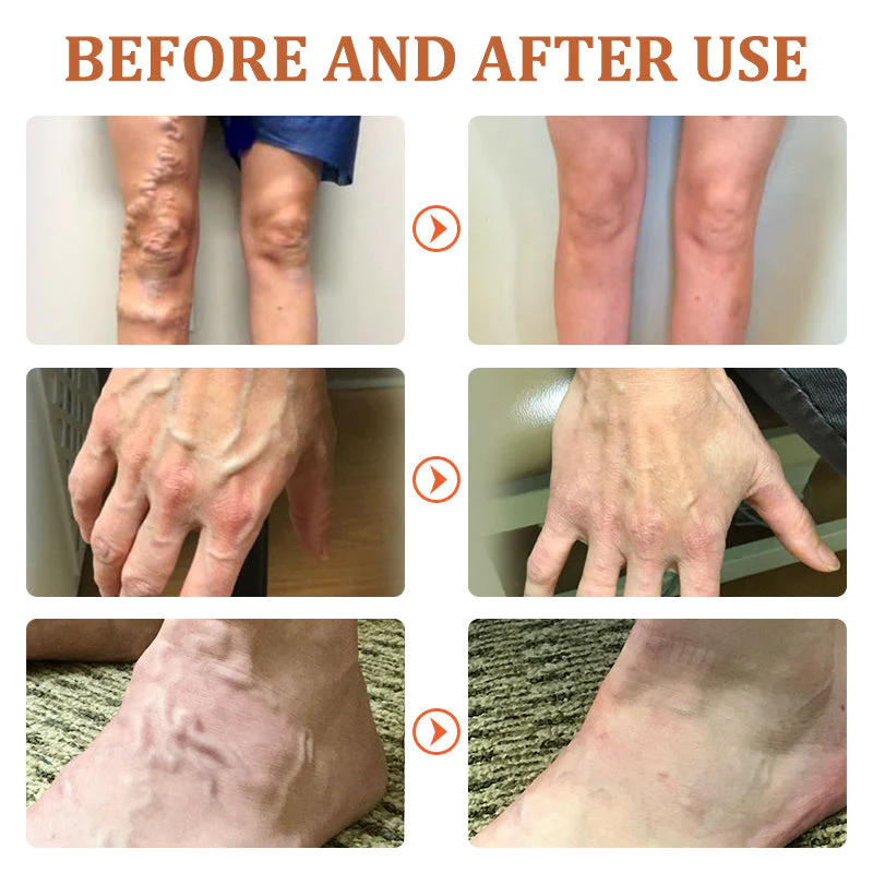 flysmus™ Vein Soothing Scrub - Image 4