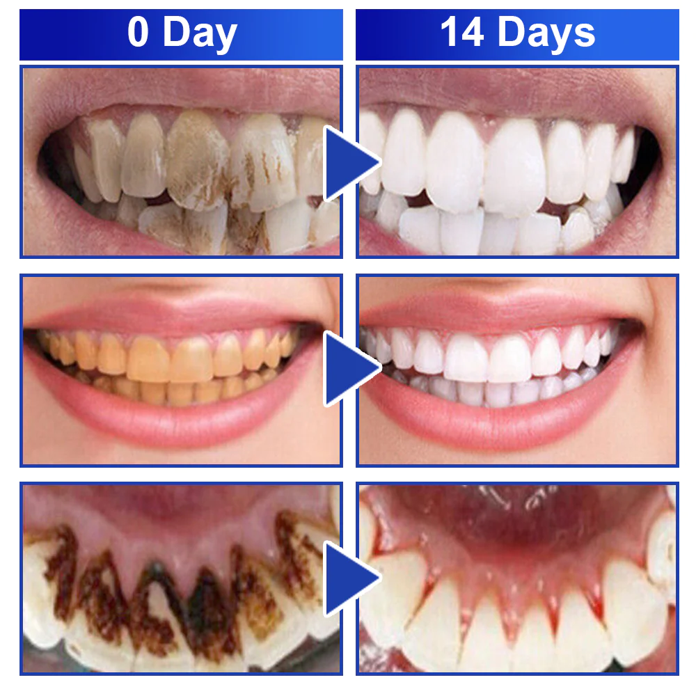 GFOUK™️ PureSmile Essence - Image 7