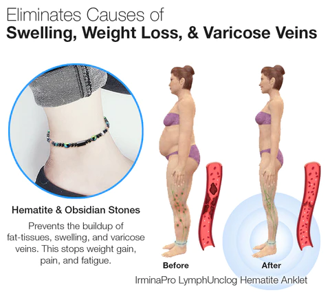 IrminaPro™ LymphUnclog Hematite Anklet - Image 5