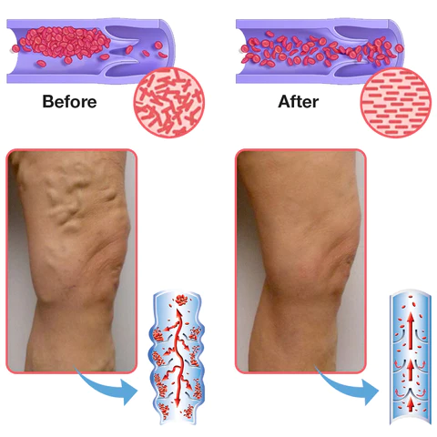 IrminaPro™ LymphUnclog Hematite Anklet - Image 6