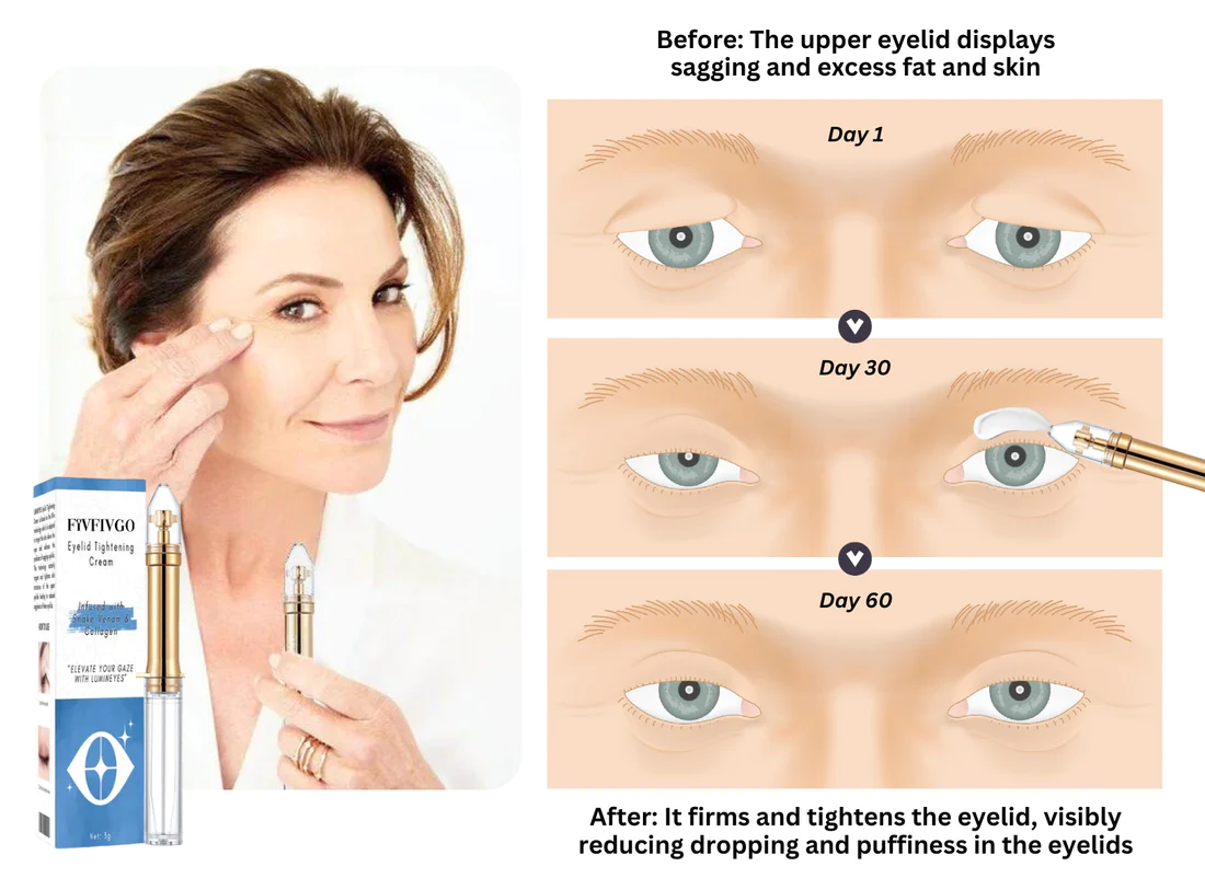 Oveallgo™ Eyelid Tightening Cream - Image 2