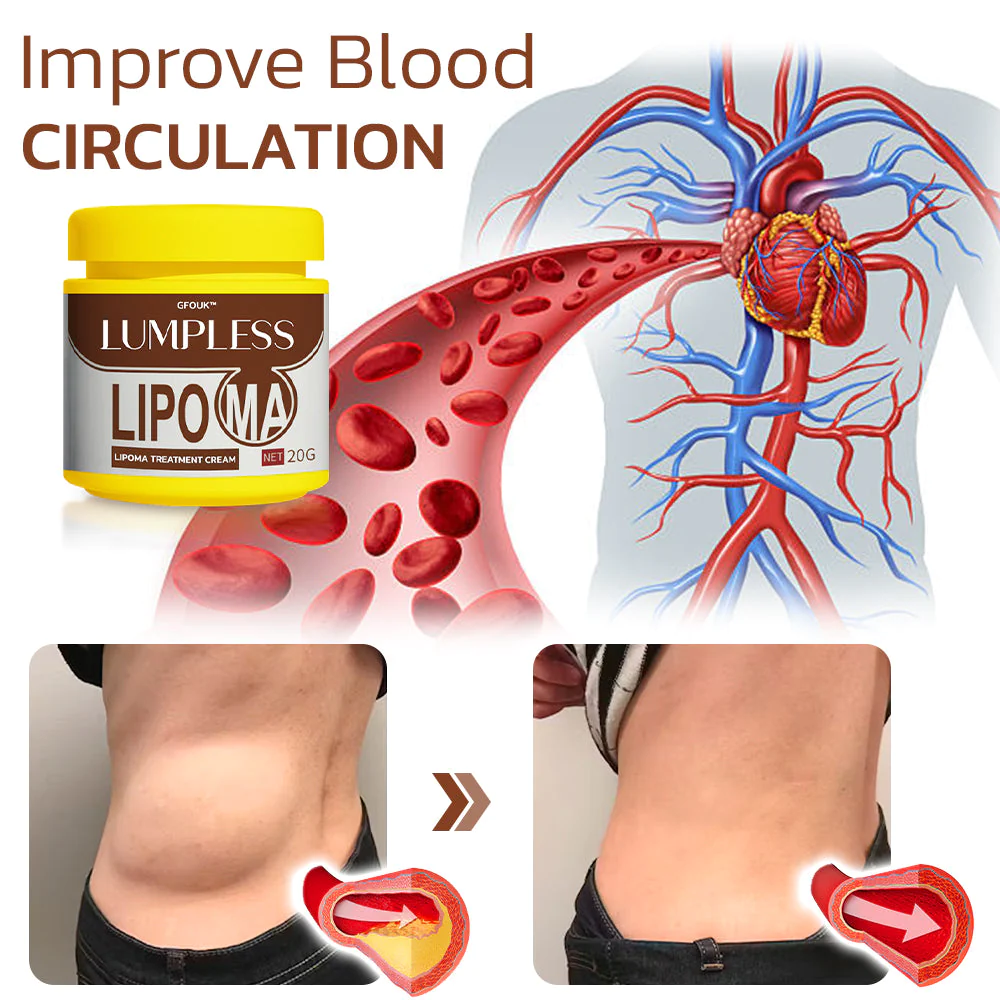 GFOUK™ Lumpless Lipoma Treatment Cream - Image 6
