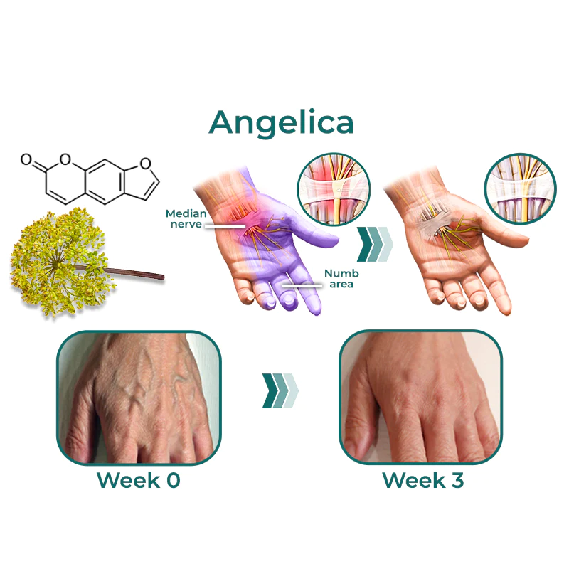 GFOUK™ NumbEase Hands and Foots Cream - Image 6