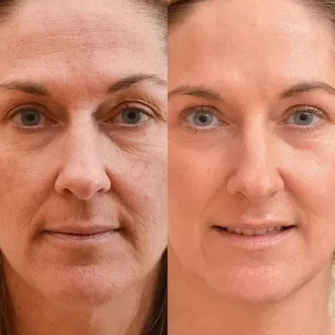 Oveallgo™ Korean Taro Peptide Deer Bone Soluble Collagen Membrane - Image 3