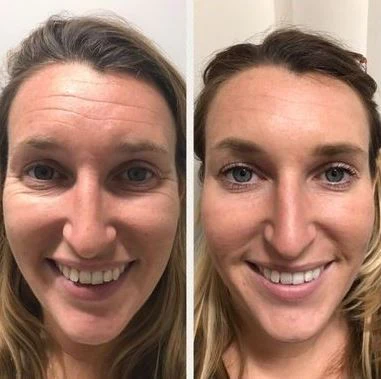 Oveallgo™ Korean Taro Peptide Deer Bone Soluble Collagen Membrane - Image 2