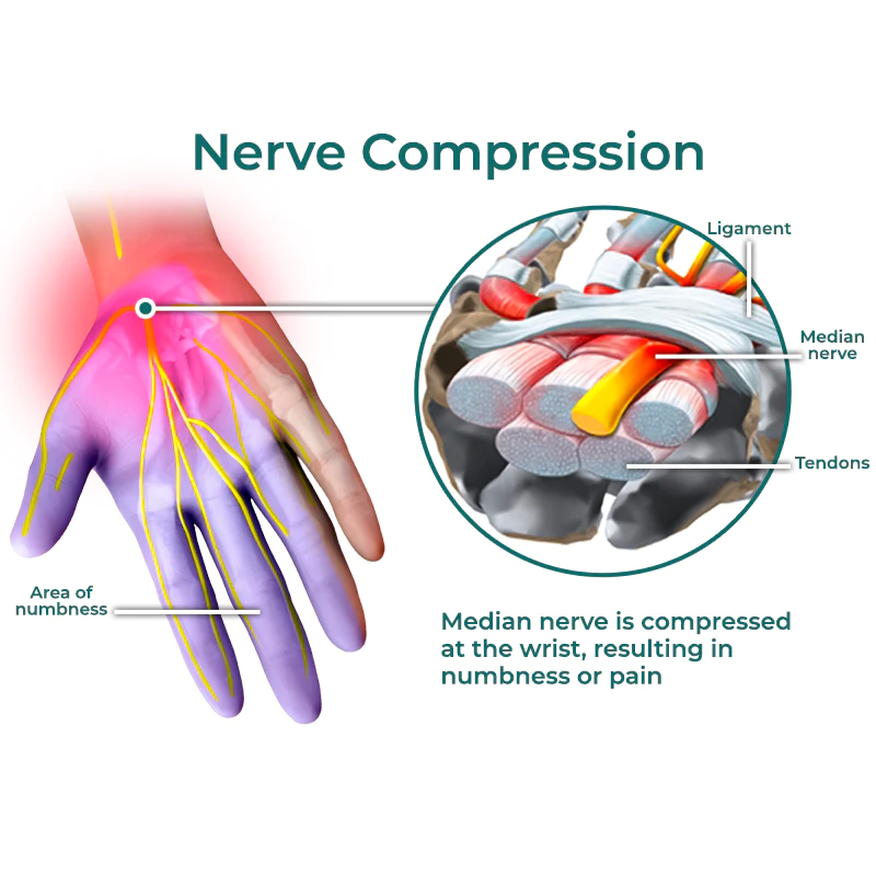 GFOUK™ NumbEase Hands and Foots Cream - Image 3