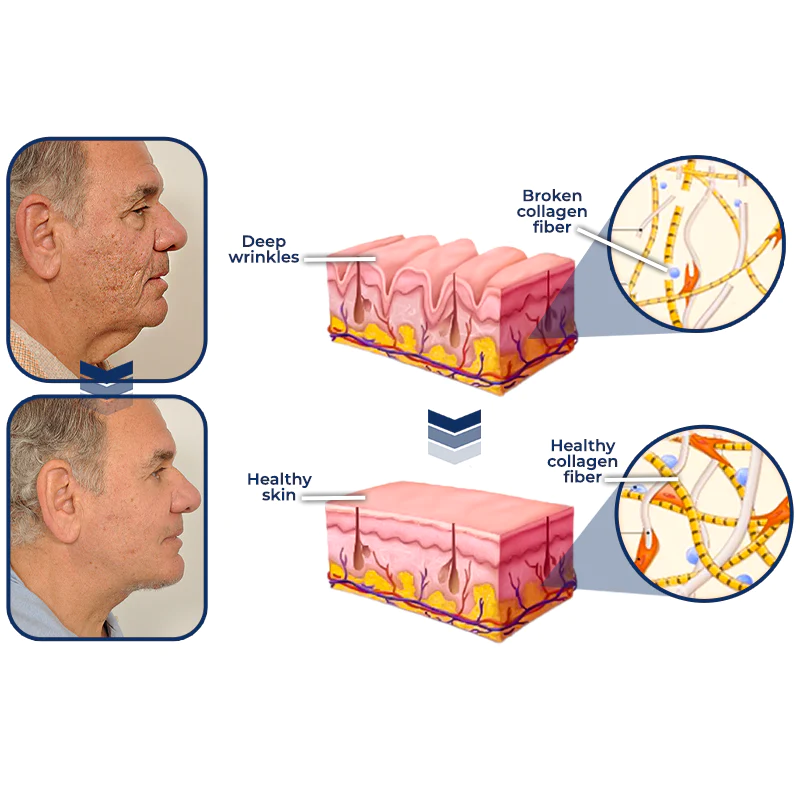flysmus™ Men's AgeRevive Collagen Cream - Image 6
