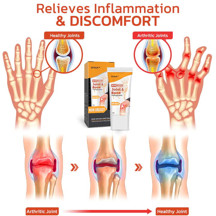 GFOUK™ DeerAntler Joint and Bone Therapy Balm - Image 5
