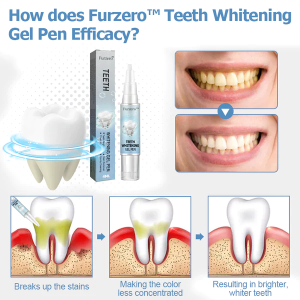 Furzero™ Teeth Whitening Gel Pen - Image 3
