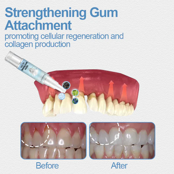 Furzero™ Teeth Whitening Gel Pen - Image 7