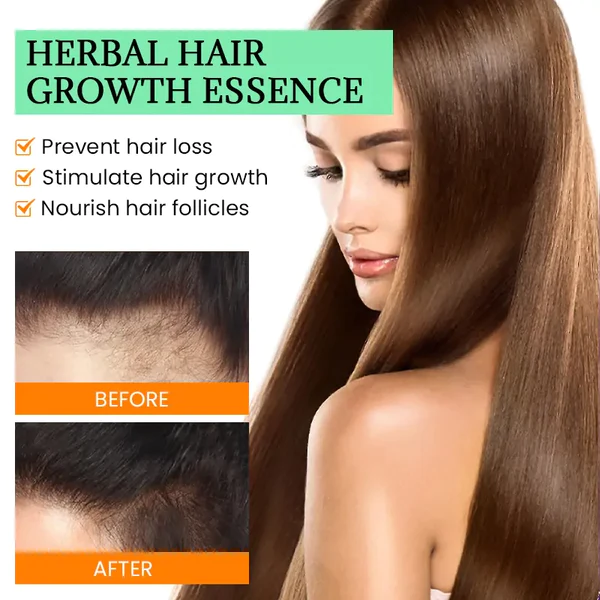 Dobshow™ Herbal Hair Strengthening Serum - Image 4