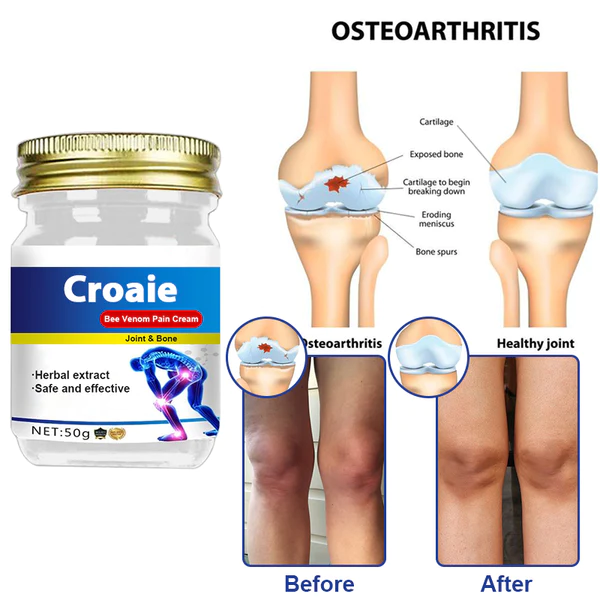 Croaie® Bee Venom Pain Cream Joint & Bone Healing - Image 2