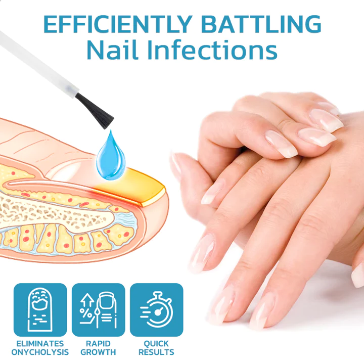 flysmus™ OnycholysisHeal Nail Strengthening And Growth Conditioner - Image 3
