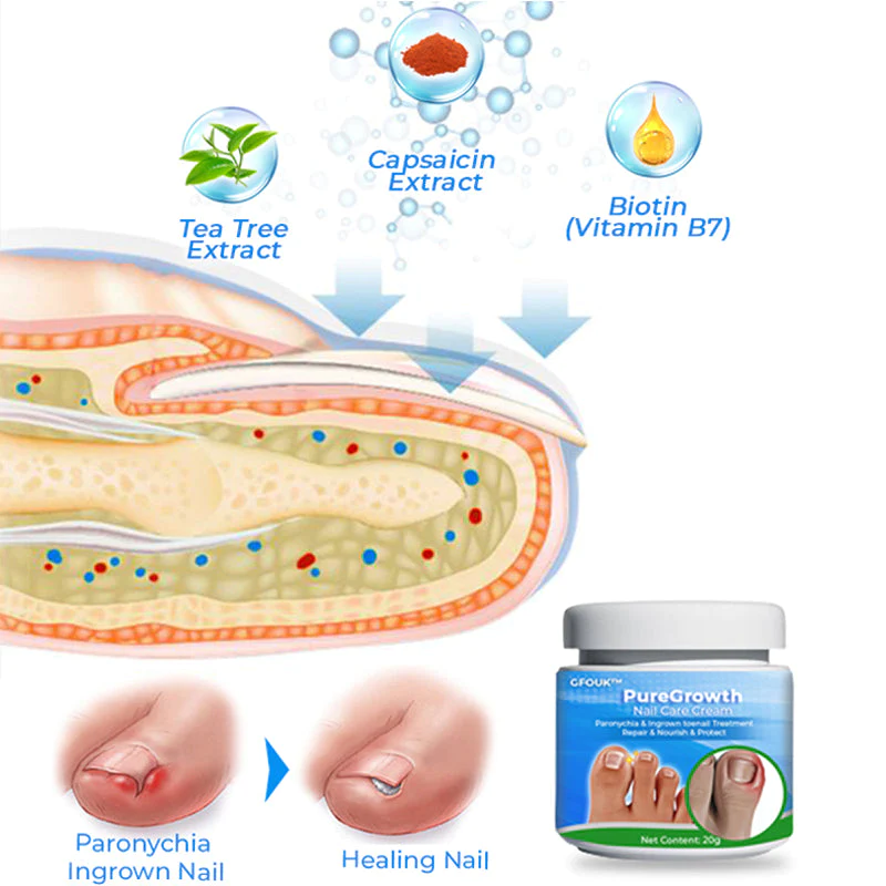 LIMETOW™ PureGrowth Nail Care Cream - Image 2