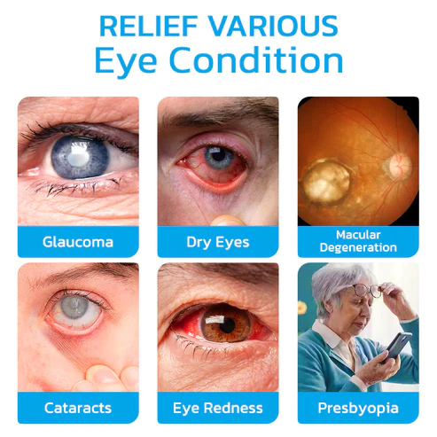 GFOUK™ Oisee Ophthal Vision Enhance Roller - Image 6