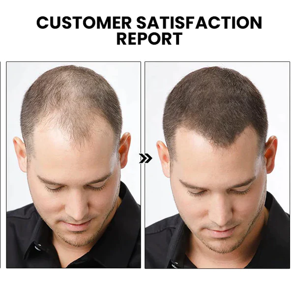 Dobshow™ Herbal Hair Strengthening Serum - Image 3