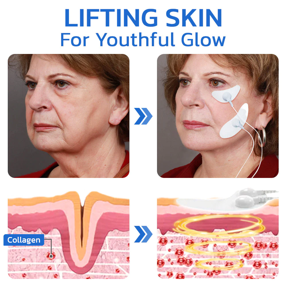 flysmus™ BeautyTENS VFace Facial Pules Device - Image 4