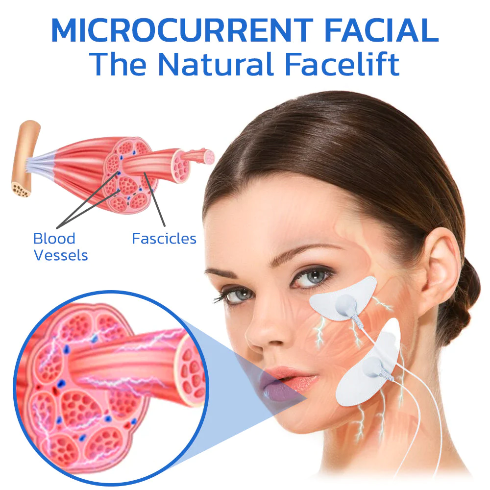 flysmus™ BeautyTENS VFace Facial Pules Device - Image 5