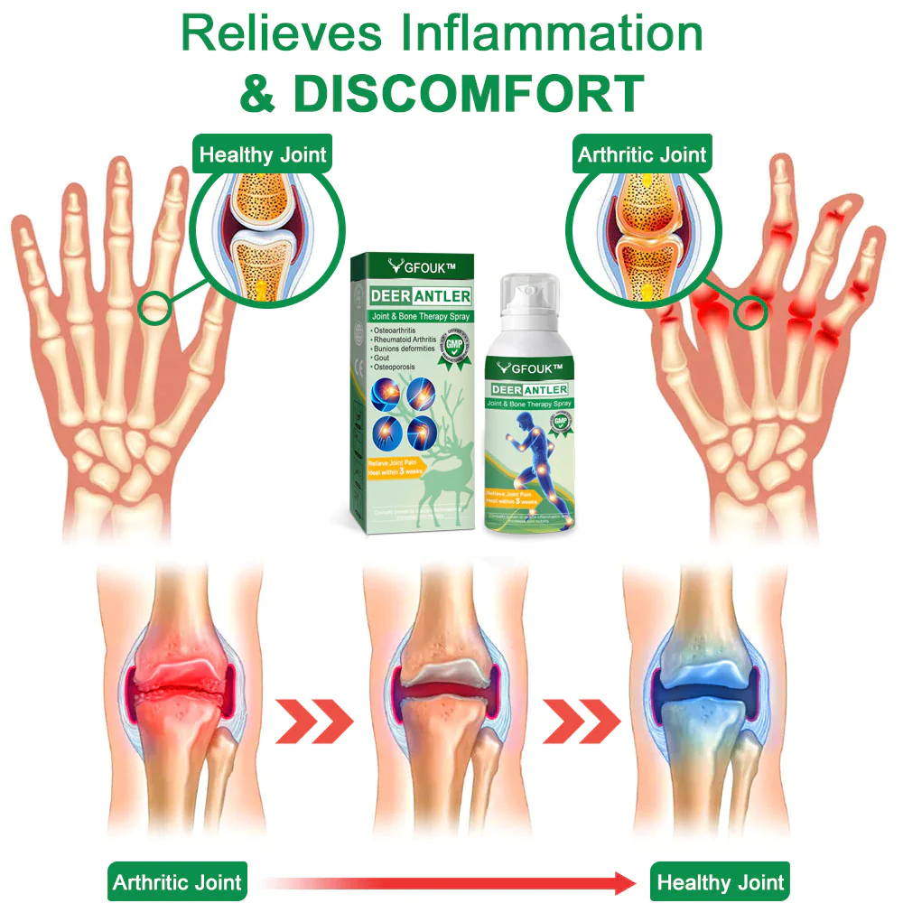 GFOUK™ DeerAntler Joint and Bone Therapy Spray - Image 5
