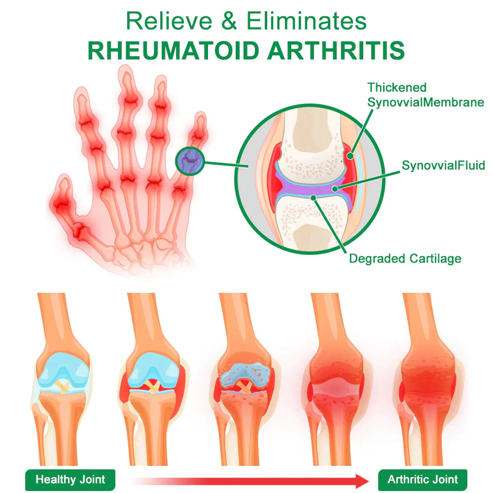 GFOUK™ DeerAntler Joint and Bone Therapy Spray - Image 4