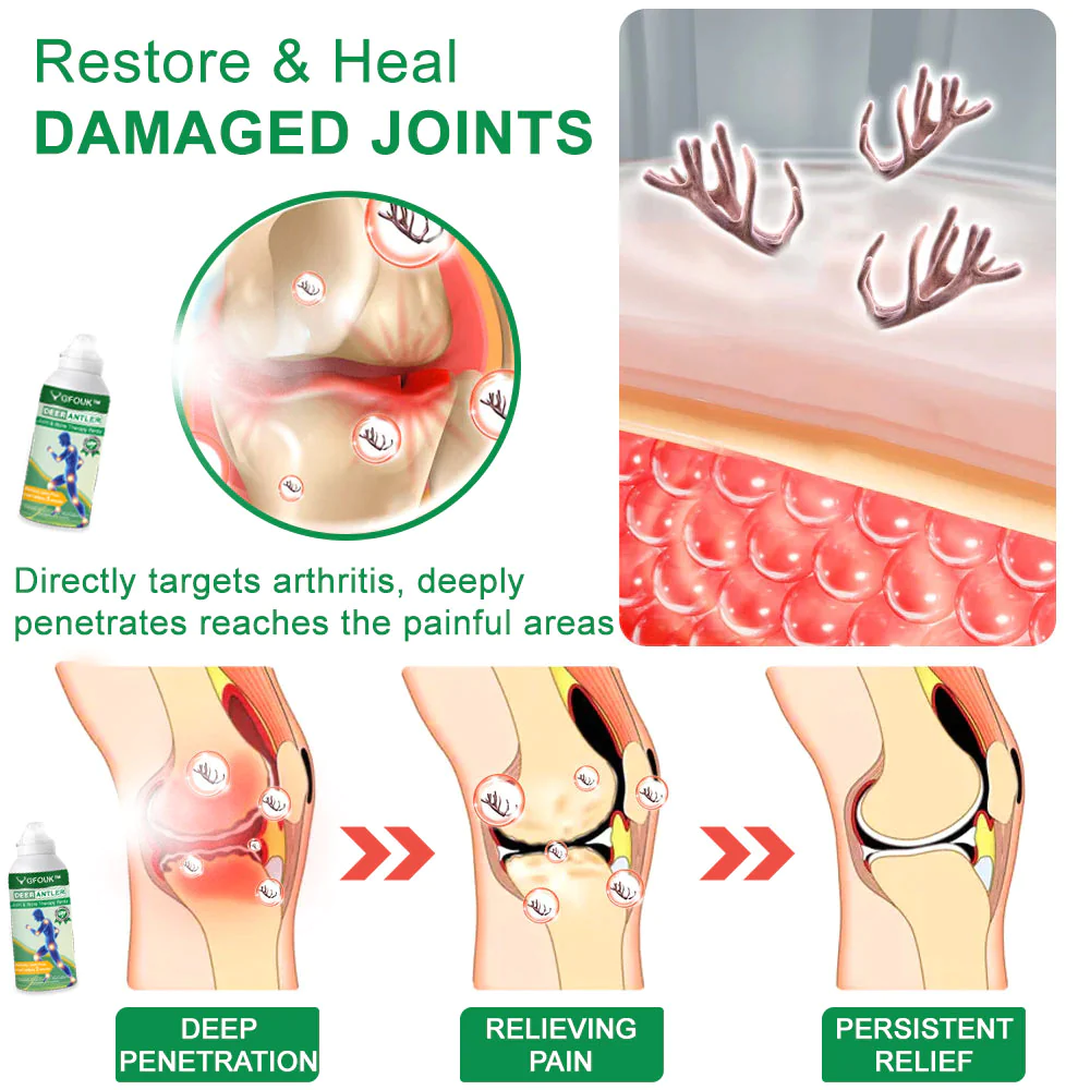 GFOUK™ DeerAntler Joint and Bone Therapy Spray - Image 3
