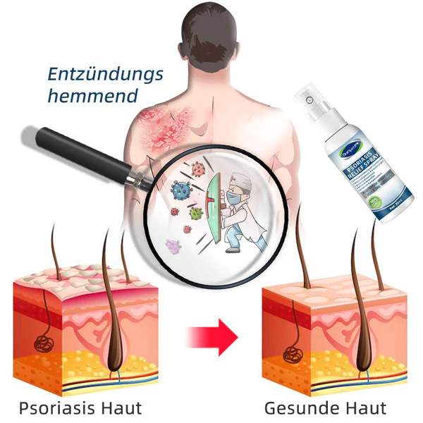 Ourlyard™ Psoriasis Treatment Spray - Image 7
