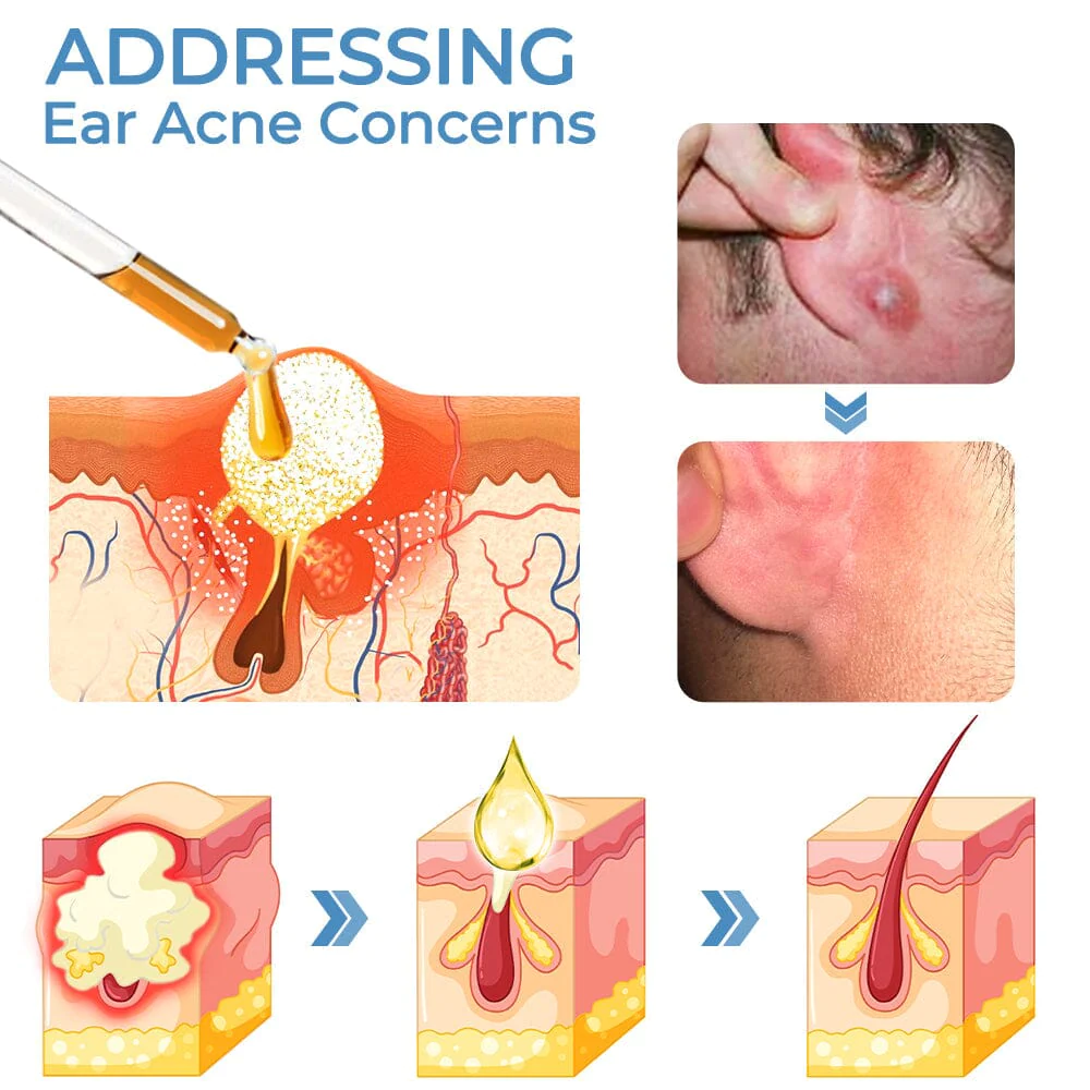 GFOUK™ OrganicHear Anti EarInfections and Tinnitus Relief Serum - Image 3
