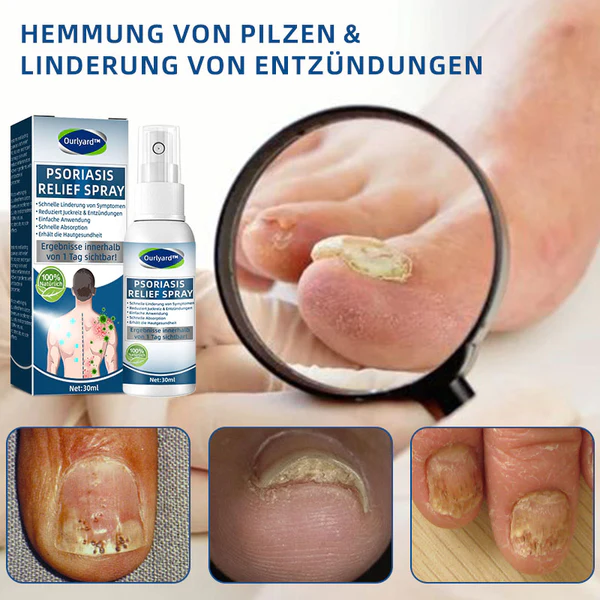 Ourlyard™ Psoriasis Treatment Spray - Image 10