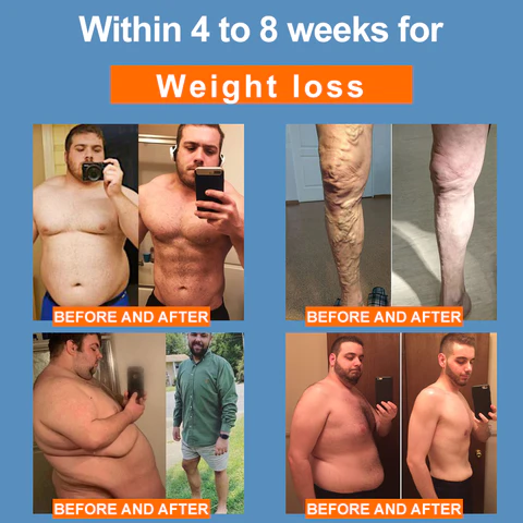 CZTICLE™ Far Infrared Ionizer Bracelet - Image 5