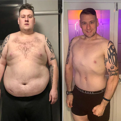 CZTICLE™ Far Infrared Ionizer Bracelet - Image 3