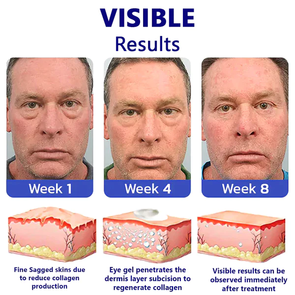 Furzero™ Deep Reviving Peptide Lifting Eye Gel - Image 5