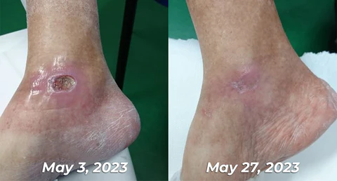 GFOUK™ GlycoWave Electric Pulse Device - Image 6