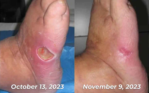 GFOUK™ GlycoWave Electric Pulse Device - Image 3