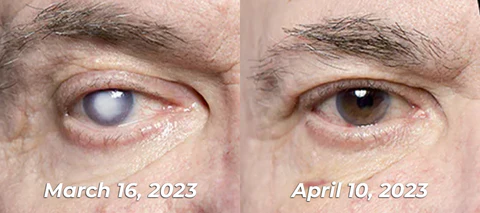 GFOUK™ GlycoWave Electric Pulse Device - Image 2