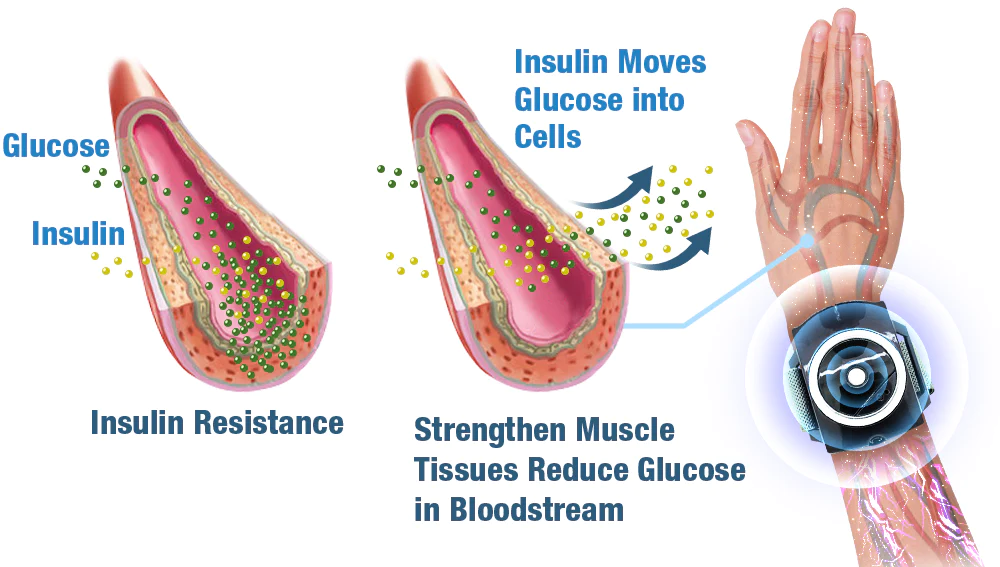 GFOUK™ GlycoWave Electric Pulse Device - Image 5