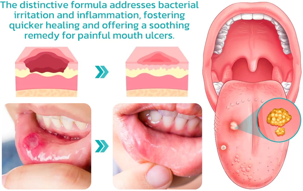 DOCTIA™ SMARTSmile Oral Mouthwash - Image 6