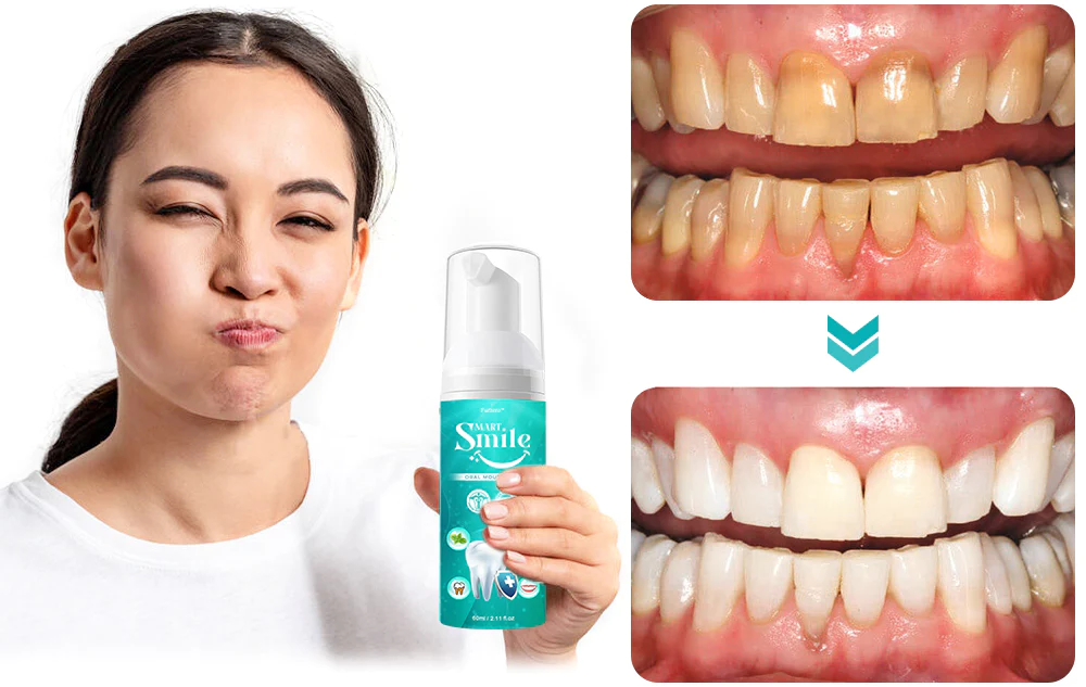 DOCTIA™ SMARTSmile Oral Mouthwash - Image 5