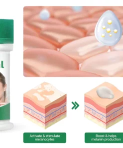 GFOUK™ VitiligoHeal Soothing Cream