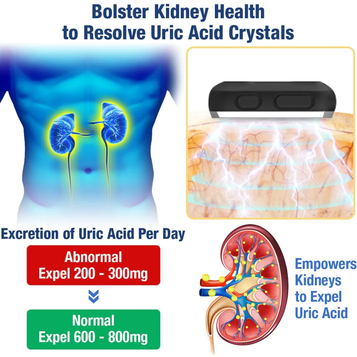 GFOUK™ UricEase Microcurrent Therapy Device - Image 3