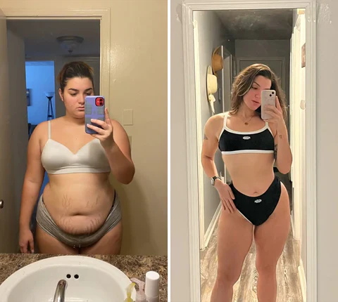 GFOUK™Female Intimate Care Patch - Image 4