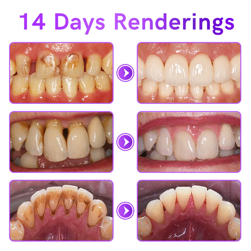 Furzero™ Propolis Gum Care Gel - Image 5