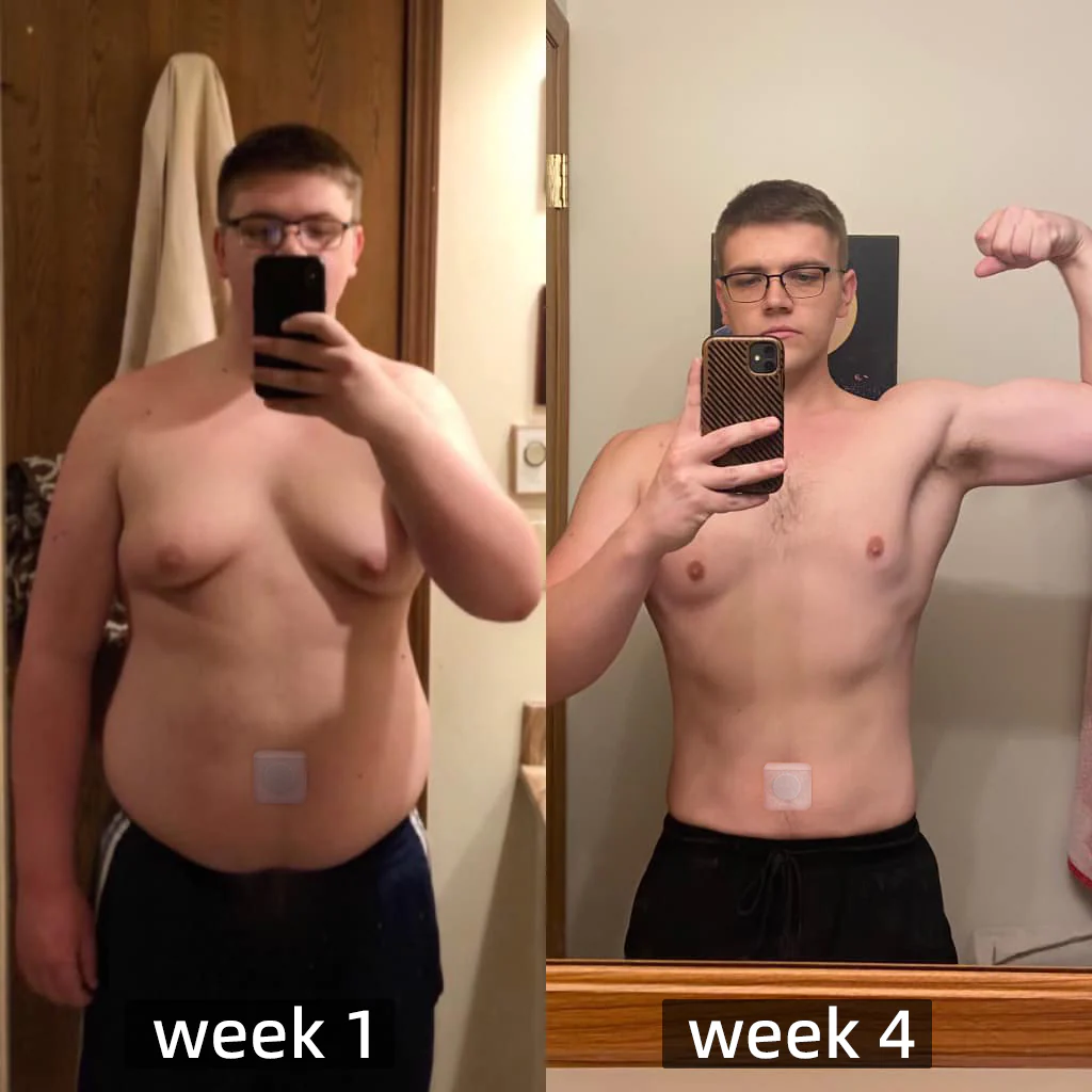 Dobshow™ BeeVenom Lymphatic Body Contouring Patch - Image 2