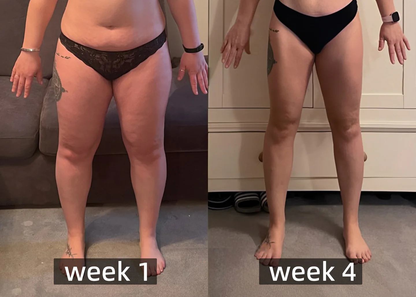 Dobshow™ BeeVenom Lymphatic Body Contouring Patch - Image 3