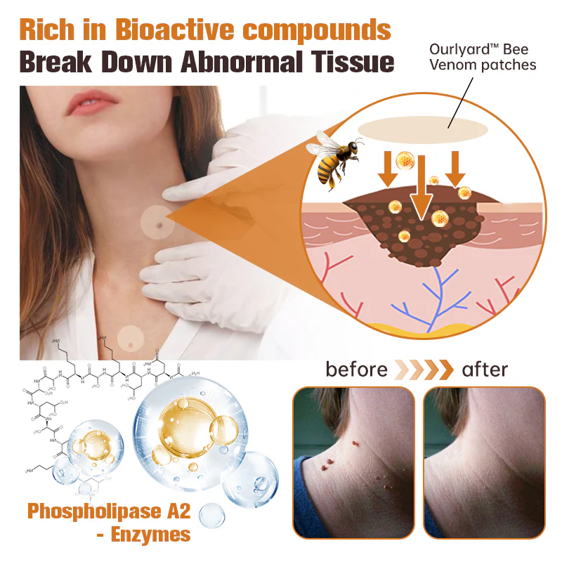 Ourlyard™ WartGone Bee Venom Treatment Patch - Image 5