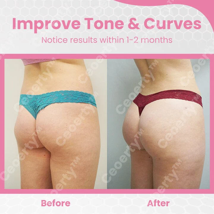 Seurico™ Bottom Enhancement Posterior Shaping Cream - Image 4