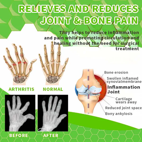 Lotmay™ Cannabidiol Professional Joint Gel - Image 4