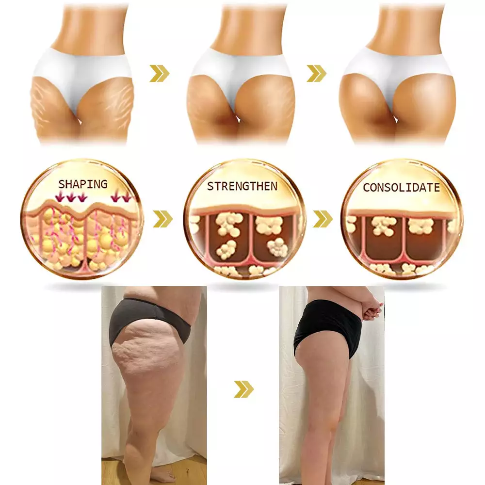 Flysmus™ BotoxLift SYN-AKE Anti-Aging Firming Cream