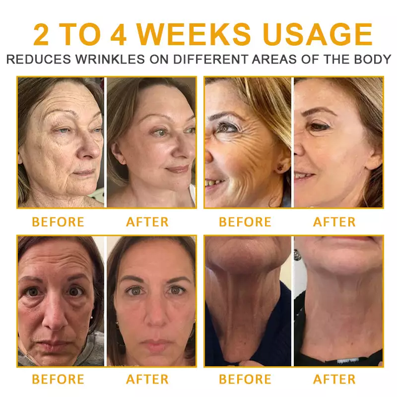 Flysmus™ BotoxLift SYN-AKE Anti-Aging Firming Cream